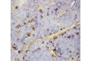 Anti-CXCL16 antibody, IHC(P) IHC(P): Mouse Spleen Tissue (CXCL16 抗体  (Middle Region))