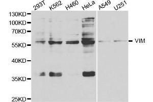 Western Blotting (WB) image for anti-Vimentin (VIM) (AA 1-200) antibody (ABIN3016292)