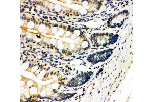 Immunohistochemistry (IHC) image for anti-Nuclear Factor of kappa Light Polypeptide Gene Enhancer in B-Cells 2 (NFKB2) (AA 5-21), (N-Term) antibody (ABIN3044018)