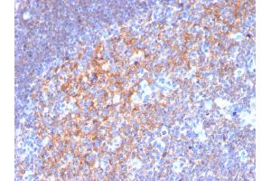 Immunohistochemistry (IHC) image for anti-CD19 Molecule (CD19) (AA 96-281) antibody (ABIN6941101)