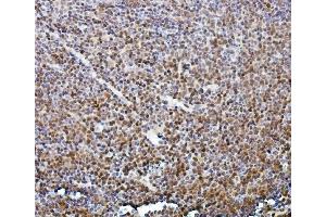 IHC analysis of ETF/TEAD2 using anti-ETF/TEAD2 antibody (ABIN7599879).