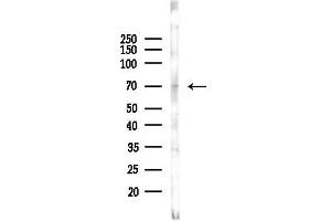 anti-UDP Glucuronosyltransferase 1 Family, Polypeptide A9 (UGT1A9) (C-Term) antibody