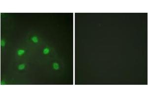 Immunofluorescence analysis of HeLa cells, using hnRNP L Antibody. (HNRNPL 抗体  (AA 61-110))