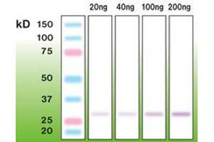 Image no. 1 for anti-Trypsin (C-Term) antibody (ABIN6756694) (Trypsin 抗体  (C-Term))