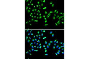 Immunofluorescence analysis of HeLa cell using GALNT2 antibody. (GALNT2 抗体)