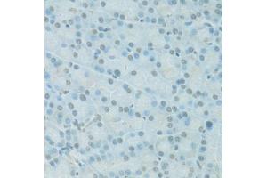 Immunohistochemistry of paraffin-embedded rat pancreas using PDC antibody (ABIN6293719) at dilution of 1:100 (40x lens). (Phosducin 抗体)