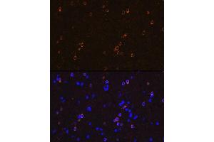 Immunofluorescence analysis of rat brain using NMD Rabbit mAb (ABIN7267417) at dilution of 1:100 (40x lens). (GRIN1/NMDAR1 抗体)