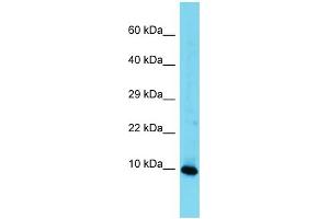 Western Blotting (WB) image for anti-High Mobility Group Nucleosomal Binding Domain 3 (HMGN3) (Middle Region) antibody (ABIN2788959) (HMGN3 抗体  (Middle Region))