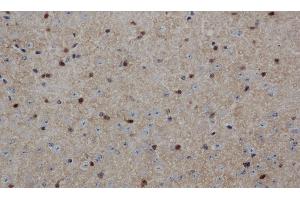 Immunohistochemistry of paraffin-embedded Mouse brain using ENO1 Polyclonal Antibody at dilution of 1:50 (ENO1 抗体)