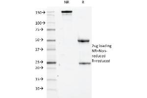 SDS-PAGE Analysis Purified CD84 Mouse Monoclonal Antibody (152-1D5). (CD84 抗体)
