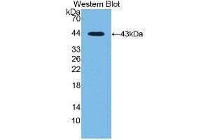 Detection of Recombinant CTBS, Human using Polyclonal Antibody to Di-N-Acetyl Chitobiase (CTBS) (CTBS 抗体  (AA 47-385))
