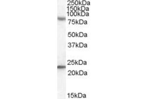 ABIN263162 (0. (DHX58 抗体  (C-Term))