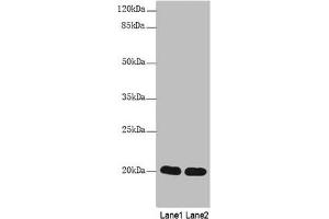 Western Blot All lanes: CABP5 antibody at 12 μg/mL Lane 1: Mouse kidney tissue Lane 2: Mouse thymus tissue Secondary Goat polyclonal to rabbit IgG at 1/10000 dilution Predicted band size: 20 kDa Observed band size: 20 kDa (CABP5 抗体  (AA 1-173))
