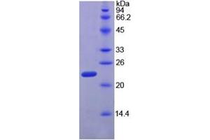 Ribonuclease P (AA 91-259) (Active) protein (His tag)