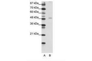 Image no. 1 for anti-Nuclear Factor I/B (NFIB) (AA 187-236) antibody (ABIN202482) (NFIB 抗体  (AA 187-236))