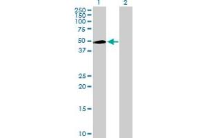 Western Blot analysis of INPP5K expression in transfected 293T cell line by INPP5K MaxPab polyclonal antibody. (INPP5K 抗体  (AA 1-448))