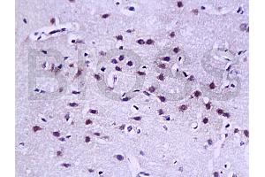 Formalin-fixed and paraffin embedded rat brain tissue labled with Anti-LAMR1(CT) Polyclonal Antibody, Unconjugated (ABIN729598) at 1:200, followed by conjugation to the secondary antibody and DAB staining (LAMR1CT (AA 201-295) 抗体)