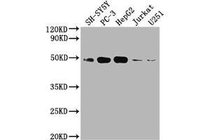 Western Blot Positive WB detected in: SH-SY5Y whole cell lysate, PC3 whole cell lysate, HepG2 whole cell lysate, Jurkat whole cell lysate, U251 whole cell lysate All lanes: EDG1 antibody at 1:2000 Secondary Goat polyclonal to rabbit IgG at 1/50000 dilution Predicted band size: 43 kDa Observed band size: 43 kDa (Recombinant S1PR1 抗体)