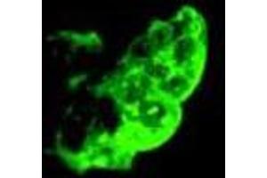 Immunofluorescence staining of methanol-fixed NTERA-2 cl. (TRA1-81 抗体)