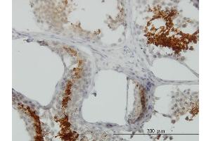 Immunoperoxidase of monoclonal antibody to GAPDHS on formalin-fixed paraffin-embedded human testis. (GAPDHS 抗体  (AA 1-408))