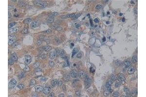 Immunohistochemistry (IHC) image for anti-Nuclear Factor kappa B (NFkB) (AA 805-892) antibody (ABIN7442525)
