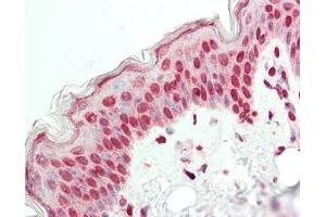Immunohistochemistry (Paraffin-embedded Sections) (IHC (p)) image for anti-E74-Like Factor 2 (Ets Domain Transcription Factor) (ELF2) (AA 103-152) antibody (ABIN6756526)