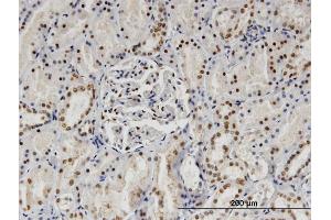 Immunoperoxidase of monoclonal antibody to SP140 on formalin-fixed paraffin-embedded human kidney. (SP140 抗体  (AA 504-612))