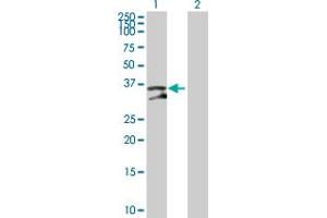 Western Blot analysis of UNG expression in transfected 293T cell line by UNG MaxPab polyclonal antibody. (UNG 抗体  (AA 1-304))