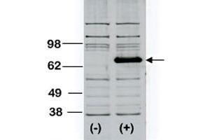 Western blot analysis of BTK polyclonal antibody  transiently transfected HEK293 cell line lysate (1 ug/lane). (BTK 抗体  (AA 209-239))