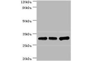 Western blot All lanes: HNRNPA0 antibody at 12 μg/mL Lane 1: Mouse brain tissue Lane 2: Hela whole cell lysate Lane 3: Jurkat whole cell lysate Secondary Goat polyclonal to rabbit IgG at 1/10000 dilution Predicted band size: 31 kDa Observed band size: 31 kDa (HNRNPA (AA 1-180) 抗体)