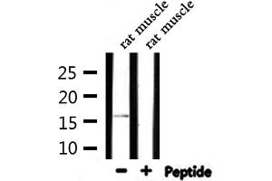 Western blot analysis of extracts from rat muscle, using TOMM20 Antibody. (TOMM20 抗体  (Internal Region))