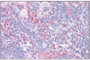 Human Thymus: Formalin-Fixed, Paraffin-Embedded (FFPE) (Galectin 9 抗体  (Internal Region))