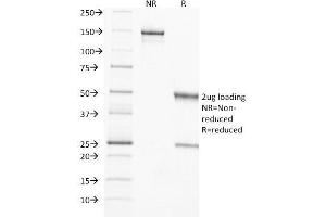 SDS-PAGE Analysis Purified TIMP2 Mouse Monoclonal Antibody (3A4). (TIMP2 抗体  (N-Term))