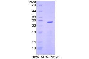 SDS-PAGE analysis of Mouse Sprouty Homolog 2 Protein. (SPRY2 蛋白)