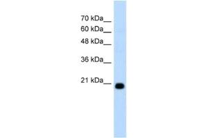 Western Blotting (WB) image for anti-F-Box Protein 25 (FBXO25) antibody (ABIN2462666) (FBXO25 抗体)