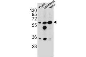 western blot analysis of Glycine amidinotransferase antibody (N-term) in HL-60,MDA-MB453,K562 cell line lysates (35ug/lane). (GATM 抗体  (N-Term))