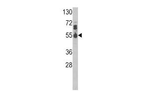 Western blot analysis of IL17RB Antibody (Center) (ABIN390727 and ABIN2841000) in MDA-M cell line lysates (35 μg/lane). (IL17 Receptor B 抗体  (AA 207-234))