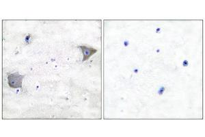 Immunohistochemistry (IHC) image for anti-Platelet Derived Growth Factor Receptor alpha (PDGFRA) (C-Term) antibody (ABIN1848739) (PDGFRA 抗体  (C-Term))