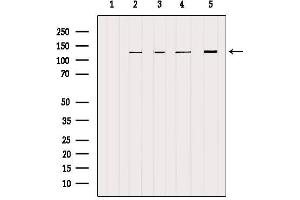 Western blot analysis of extracts from various samples, using NCKAP1 Antibody.
