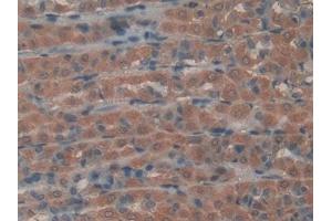 Detection of GREM1 in Rat Intestine Tissue using Polyclonal Antibody to Gremlin 1 (GREM1) (GREM1 抗体  (AA 26-184))