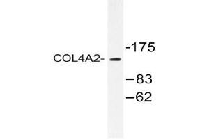 Western blot (WB) analysis of COL4A2 antibody in extracts from Jurkat cells. (COL4a2 抗体  (Chain alpha 2))