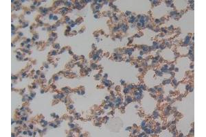 Detection of TM in Mouse Lung Tissue using Polyclonal Antibody to Thrombomodulin (TM) (Thrombomodulin 抗体  (AA 31-167))