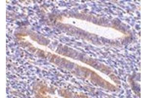Immunohistochemistry of TIM-1 in human uterus tissue with this product at 10 μg/ml. (HAVCR1 抗体  (N-Term))