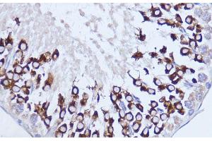 Immunohistochemistry of paraffin-embedded Rat testis using Polyclonal AntibodyPC1 Polyclonal Antibody at dilution of 1:100 (40x lens). (PC1 抗体)