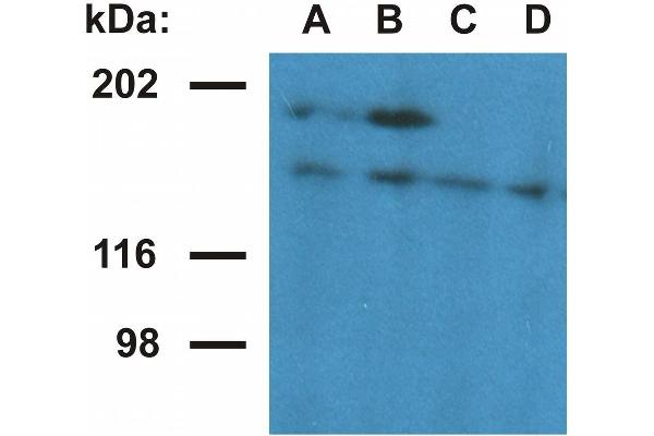 Ubinuclein 1 抗体  (AA 1-190)