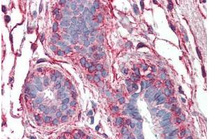 Human Breast: Formalin-Fixed, Paraffin-Embedded (FFPE) (PAK1 抗体  (AA 191-280))