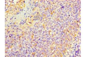 Immunohistochemistry of paraffin-embedded human tonsil tissue using ABIN7157433 at dilution of 1:100 (KRT6A 抗体  (AA 2-564))
