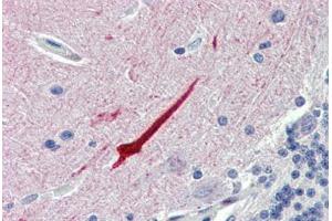 Brain, cerebellum, Human: Formalin-Fixed, Paraffin-Embedded (FFPE) (Septin 11 抗体  (N-Term))