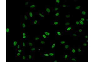 Immunofluorescent analysis of Hela cells (sodium butyrate, 30 mM, 4h) using ABIN7139190 at dilution of 1:100 and Alexa Fluor 488-congugated AffiniPure Goat Anti-Rabbit IgG(H+L) (HIST1H1C 抗体  (acLys62))