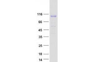 Western Blotting (WB) image for Cas-Br-M (Murine) Ecotropic Retroviral Transforming Sequence (CBL) protein (Myc-DYKDDDDK Tag) (ABIN2713254)
